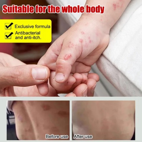 Miaojiang Herbal Anti-Itch Cream