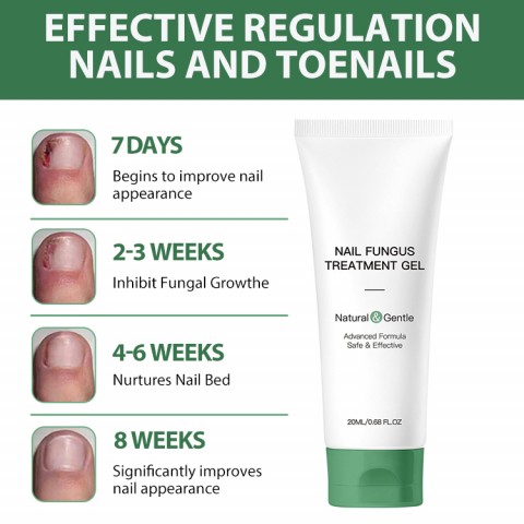 Nail Fungus Treatment Gel