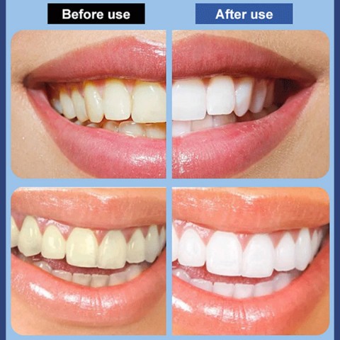 Hyaluronic Acid Brightening Toothpaste