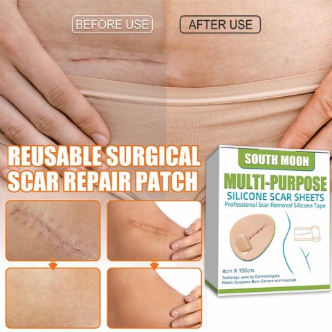 Silicone scar tape