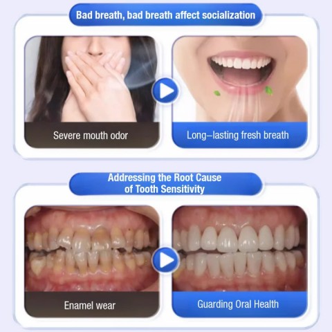 Dental Separating Agents