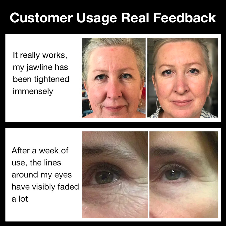 Mothers Day Promotion-100% legit,one year warranty-Skin Lifting & Firming Massage Wrinkle Remove V Face Therapy Beauty Device-Buy Now Get Free Matching Cream