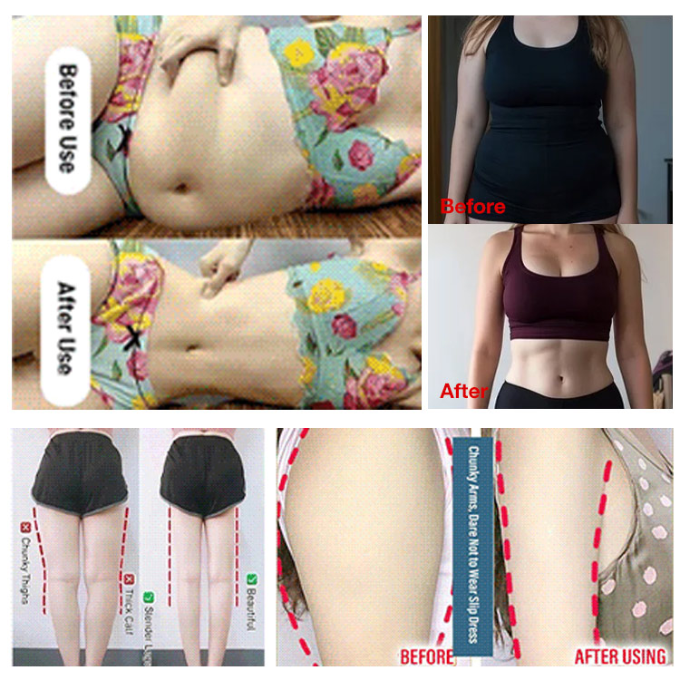 Easter Promo - Upgraded Smart Stirrup Puller - Do it 10 mins every day. Get a perfect figure like a model. no need running to lose weight	